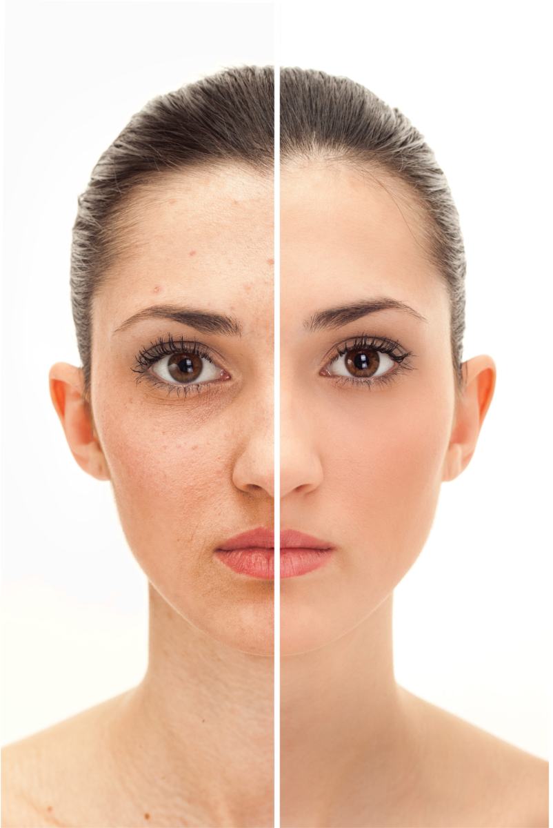 Velahí Depilación Láser y Estética