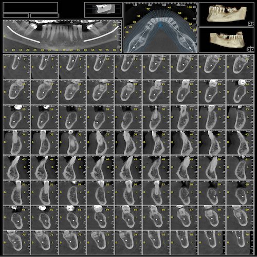 Radiología Dental Móstoles